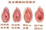 Helpful illustrative picture. With labels!