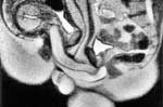 MRI Coitus